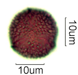 Australian Honey Pollen Under the Microscope
