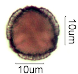Australian Honey Pollen Under the Microscope