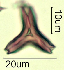 Australian Honey Pollen Under the Microscope