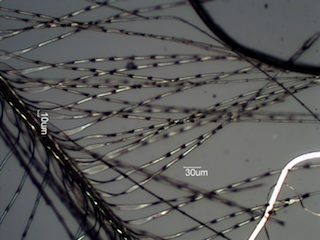 House Finch (Fringilidae) Under the Microscope