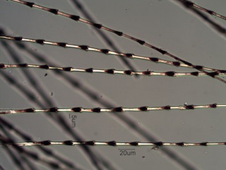 House Finch (Fringilidae) Under the Microscope