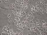 Human Skin Flakes