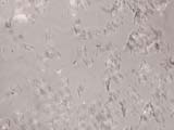 Stress Birefringence in Skin Flakes
