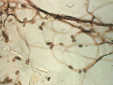 Fungal Hyphae