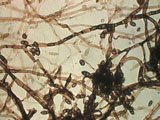 Fungal Hyphae