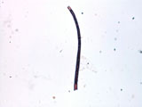 Fungal Hyphae