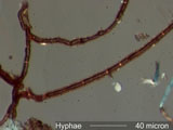 Fungal Hyphae