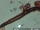 Fungal Hyphae