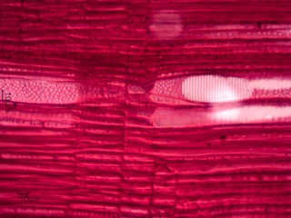 Ilex opaca, Radial-Section
