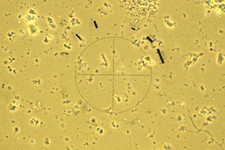 Field 1 with Proper Phase Alignment