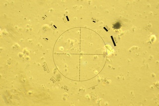 Field 2 with Improper Phase Alignment
