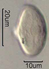 Indian Celery Pollen Under the Microscope