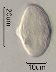 Indian Celery Pollen Under the Microscope