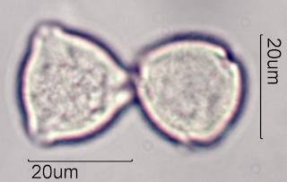 Indian Plum Pollen Under the Microscope