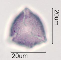 Indian Plum Pollen Under the Microscope