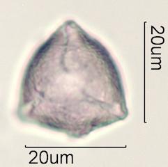Indian Plum Pollen Under the Microscope