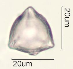 Indian Plum Pollen Under the Microscope