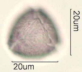 Indian Plum Pollen Under the Microscope