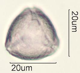Indian Plum Pollen Under the Microscope