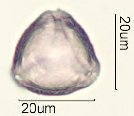 Indian Plum Pollen Under the Microscope