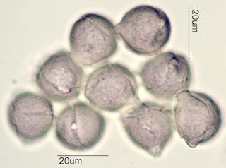 Indian Plum Pollen Under the Microscope