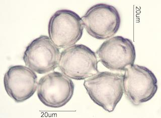 Indian Plum Pollen Under the Microscope