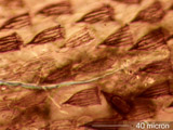 Insect Hair