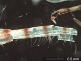 Insect Body Fragment