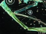 Insect Body Fragment