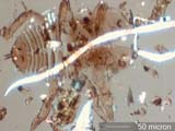 Insect Larval Cast