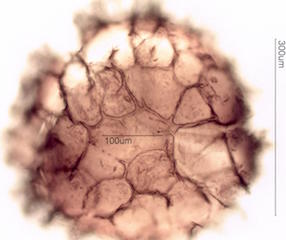 Isoetes macrospora Spore under the Microscope