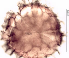 Isoetes macrospora Spore under the Microscope