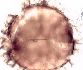 Isoetes macrospora Spore under the Microscope