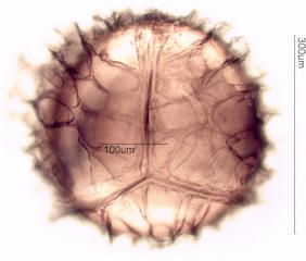 Isoetes macrospora Spore under the Microscope