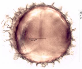 Isoetes macrospora Spore under the Microscope