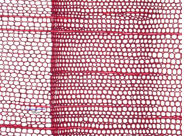 Juniperus Virginiana, Cross-Section