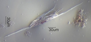 Kellicottia bostoniensis Under the Microscope