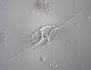 Kellicottia bostoniensis Under the Microscope