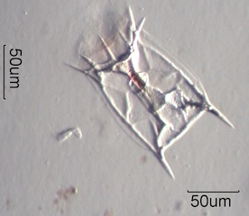 Keratella quadrata