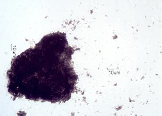 Kitchen Grease Fire Debris
