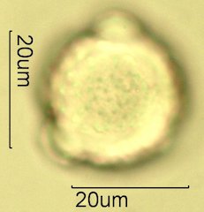 Knapweed Pollen