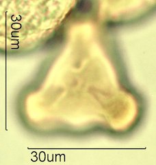 Washington State Honey Pollen Under the Microscope