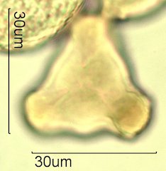 Washington State Honey Pollen Under the Microscope