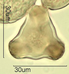 Washington State Honey Pollen Under the Microscope