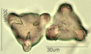 Washington State Honey Pollen Under the Microscope