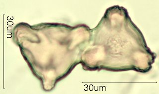Washington State Honey Pollen Under the Microscope