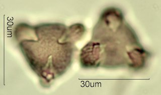 Washington State Honey Pollen Under the Microscope