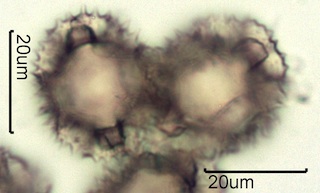 Lactuceae sp. Pollen