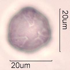 Purple deadnettle (Lamium purpureum) Pollen under the Microscope