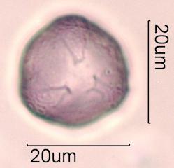 Purple deadnettle (Lamium purpureum) Pollen under the Microscope